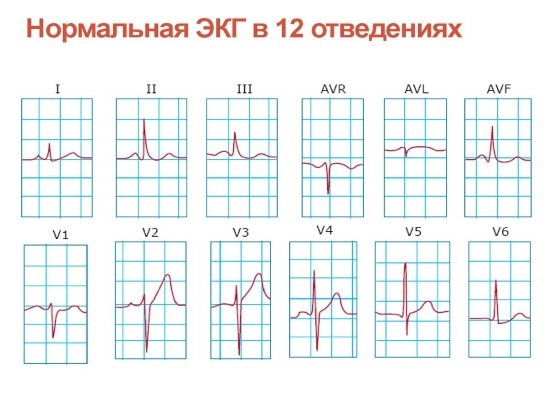 Стандартные отведения